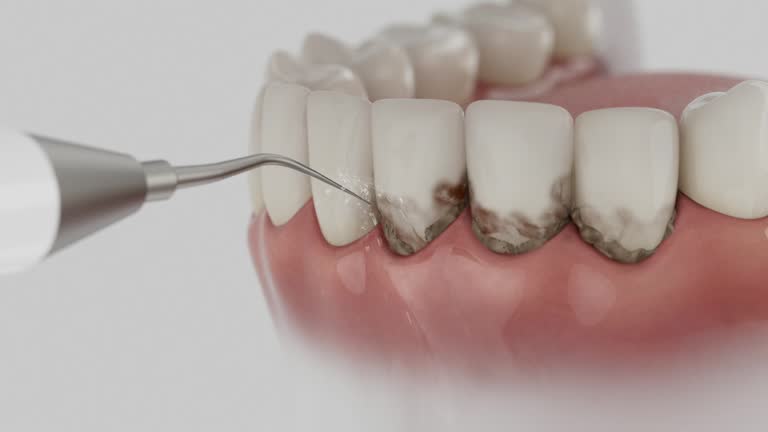 Trusted Wisdom Tooth Removal service in Coon Rapids, IA - Dentist Open Now